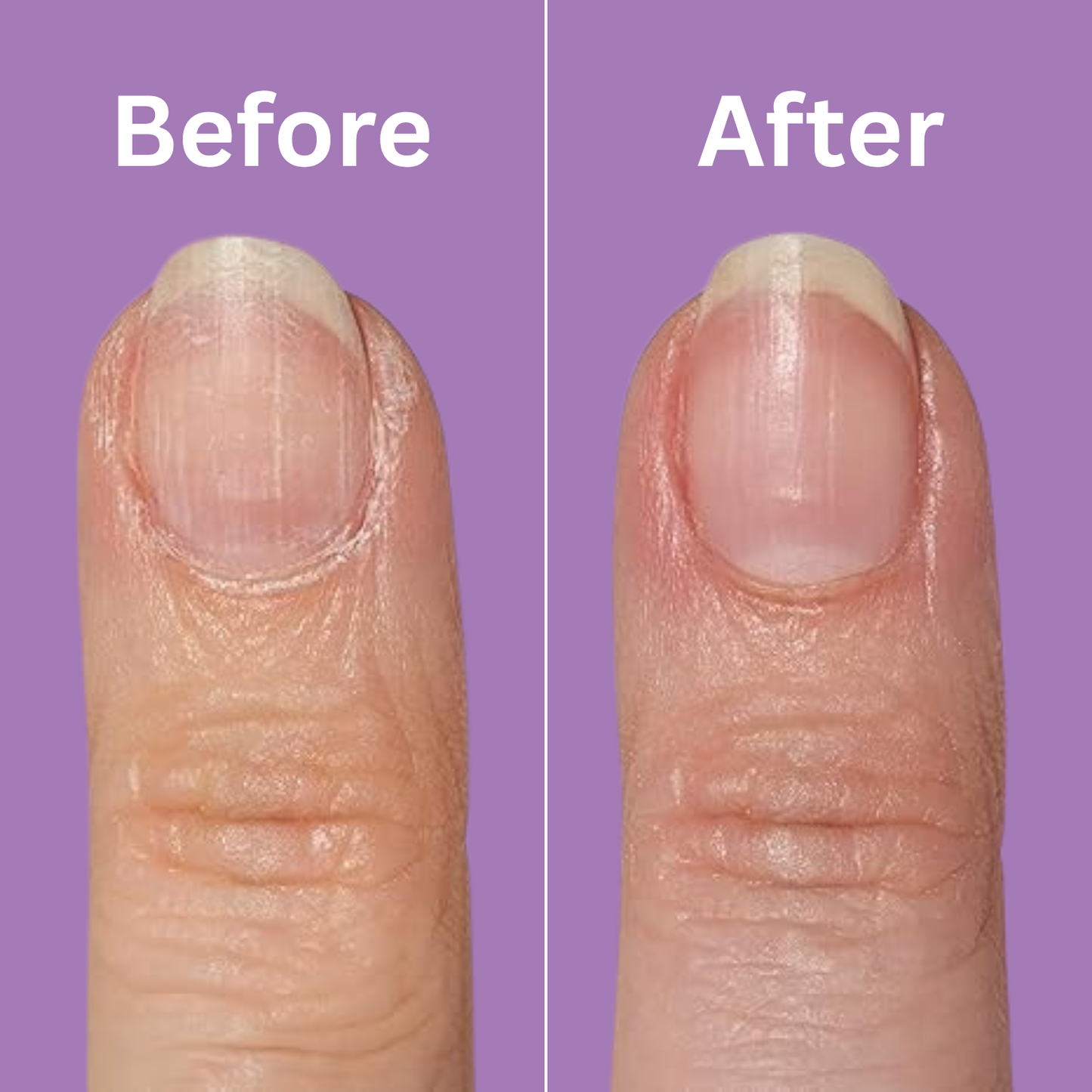 Nourishing Nail Pen