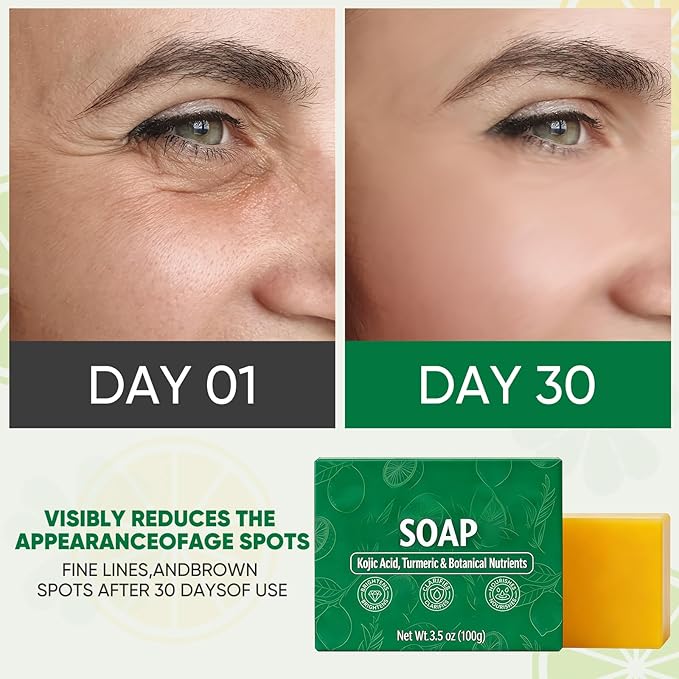 The Superfood Soap Bar For Dark Spots