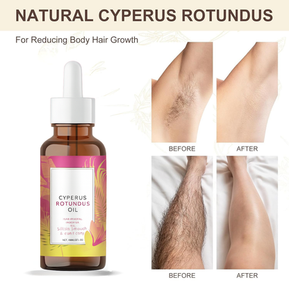 Cyperus Rotundus Skin Serum